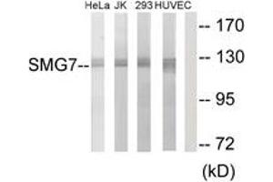 Western Blotting (WB) image for anti-Smg-7 Homolog, Nonsense Mediated mRNA Decay Factor (SMG7) (AA 521-570) antibody (ABIN2889700) (SMG7 anticorps  (AA 521-570))