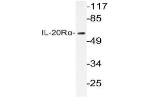 Western blot (WB) analysis of IL-20Rlha antibody in extracts from HepG2 cells. (IL20RA anticorps)