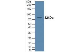 Western blot analysis of Human Jurkat Cells. (PKC theta anticorps  (AA 380-634))