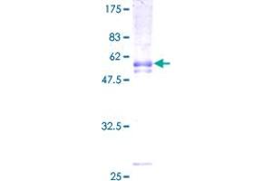 Image no. 1 for Progestin and AdipoQ Receptor Family Member VIII (PAQR8) (AA 1-354) protein (GST tag) (ABIN1313991)