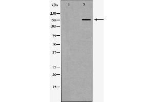 Western blot analysis of Hela whole cell lysates, using FANCD2 Antibody.
