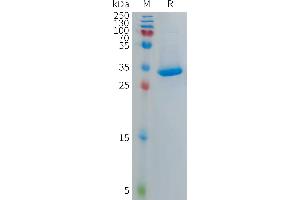 Human PF4V1 Protein, hFc Tag on SDS-PAGE under reducing condition.