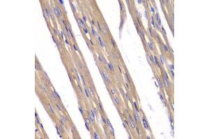 Immunohistochemistry of paraffin-embedded rat heart using FXN antibody (ABIN5970875) at dilution of 1/100 (40x lens).