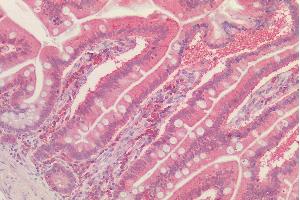 anti-Peroxiredoxin 1 (PRDX1) (Internal Region) antibody