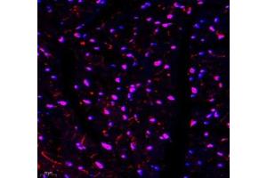 Immunofluorescence of paraffin embedded mouse heart using TYW1B (ABIN7076025) at dilution of 1: 650 (400x lens)