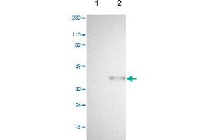 Western blot analysis of Lane 1: Human cell line RT-4, Lane 2: Human cell line U-251MG sp with SPARC polyclonal antibody . (SPARC anticorps)