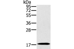 Western Blot analysis of Mouse heart tissue using RNF122 Polyclonal Antibody at dilution of 1:300 (RNF122 anticorps)