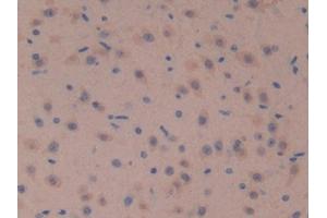 IHC-P analysis of Mouse Brain Tissue, with DAB staining. (SOSTDC1 anticorps  (AA 24-206))