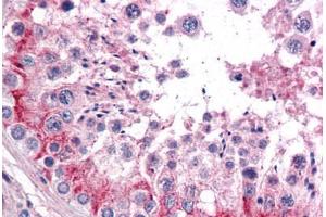 Human Testis: Formalin-Fixed, Paraffin-Embedded (FFPE) (TLN1 anticorps  (AA 1052-1150))