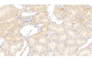 Detection of LOX in Human Kidney Tissue using Polyclonal Antibody to Lysyl Oxidase (LOX)