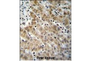 EDN1 Antibody (C-term) (ABIN655912 and ABIN2845311) immunohistochemistry analysis in formalin fixed and paraffin embedded human liver tissue followed by peroxidase conjugation of the secondary antibody and DAB staining. (Endothelin 1 anticorps  (C-Term))