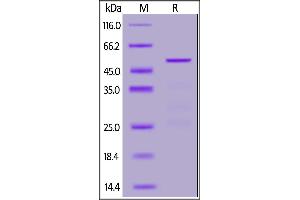 2019-nCoV (COVID-19) Nucleocapsid protein, His Tag on SDS-PAGE under reducing (R) condition.