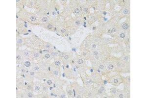 Immunohistochemistry of paraffin-embedded Rat liver using CD98 Polyclonal Antibody at dilution of 1:100 (40x lens). (SLC3A2 anticorps)