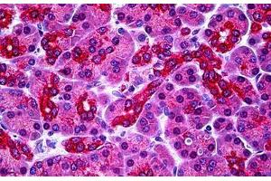 Human Pancreas: Formalin-Fixed, Paraffin-Embedded (FFPE) (PARL anticorps  (N-Term))