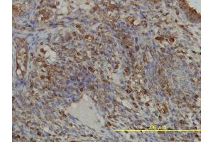 Immunoperoxidase of monoclonal antibody to GART on formalin-fixed paraffin-embedded human endometrium tissue. (GART anticorps  (AA 1-433))