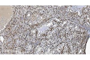 IHC analysis of SAMHD1 using anti-SAMHD1 antibody (ABIN7601514).