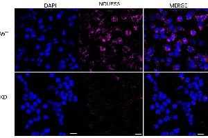 Immunocytochemical staining of HeLa cells using NDUFS3 antibody (ABIN7799557), 1:1,000), Top panel: wild-type (WT), Bottom panal: NDUFS3 shRNA knockdown (KD).