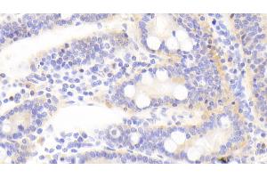 Detection of TJP2 in Human Small intestine Tissue using Polyclonal Antibody to Tight Junction Protein 2 (TJP2)
