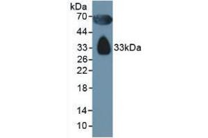 Figure. (Apolipoprotein D anticorps  (AA 21-189))