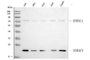 Western blot analysis of SERAC1 using anti-SERAC1 antibody (ABIN7602709). (SERAC1 anticorps  (AA 97-623))