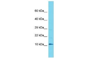 Western Blotting (WB) image for anti-Chromosome 9 Open Reading Frame 170 (C9ORF170) (N-Term) antibody (ABIN2791442) (C9ORF170 anticorps  (N-Term))