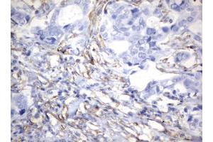 Image no. 9 for anti-Vimentin (VIM) (AA 210-466) antibody (ABIN1491200)