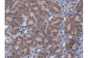 DAB staining on IHC-P; Samples: Mouse Kidney Tissue