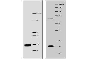 Western Blotting (WB) image for anti-Processing of Precursor 7, Ribonuclease P/MRP Subunit (POP7) antibody (ABIN1108698) (POP7 anticorps)