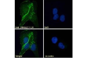 ABIN238594 Immunofluorescence analysis of paraformaldehyde fixed U2OS cells, permeabilized with 0. (EPB41L2 anticorps  (Internal Region))
