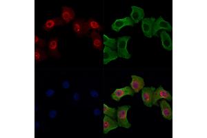 Phospho-Bub1 (Ser459) Antibody staining Hela cells(heat shock treatment) by IF/ICC. (BUB1 anticorps  (pSer459))