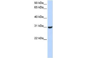 Western Blotting (WB) image for anti-Ring Finger Protein 182 (RNF182) antibody (ABIN2458750) (RNF182 anticorps)