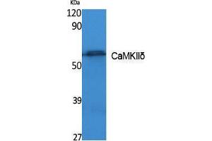 Western Blotting (WB) image for anti-Calcium/calmodulin-Dependent Protein Kinase II delta (CAMK2D) (Internal Region) antibody (ABIN3178095) (CAMK2D anticorps  (Internal Region))