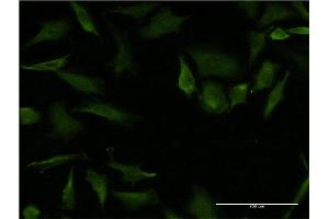 Immunofluorescence of monoclonal antibody to RHOA on HeLa cell. (RHOA anticorps  (AA 1-193))