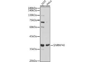 Western blot analysis of extracts of various cell lines, using SNRNP40 antibody (ABIN7270361) at 1:1000 dilution. (SNRNP40 anticorps)