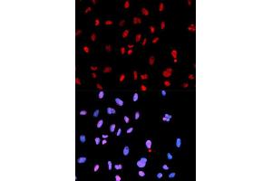 Immunofluorescence analysis of U2OS cells using Phospho-MET-Y1234 antibody (ABIN5969923). (c-MET anticorps  (pTyr1234))