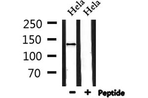 Western blot analysis of extracts from Hela, using ADAMTS19 Antibody.