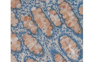 Used in DAB staining on fromalin fixed paraffin- embedded Kidney tissue (DHPS anticorps  (AA 1-369))
