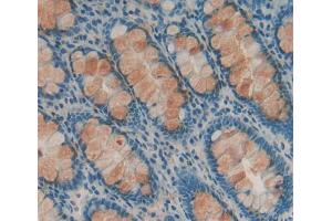 Used in DAB staining on fromalin fixed paraffin- embedded Kidney tissue