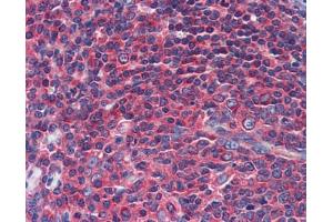 Immunohistochemistry with gut tissue