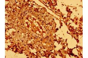 Immunohistochemistry of paraffin-embedded human lung tissue using ABIN7168815 at dilution of 1:100