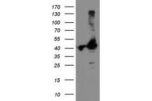 Western Blotting (WB) image for anti-TBC1 Domain Family, Member 21 (TBC1D21) antibody (ABIN1501311) (TBC1D21 anticorps)