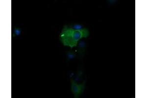 Image no. 4 for anti-Phosphoinositide-3-Kinase, Regulatory Subunit 5 (PIK3R5) antibody (ABIN1500212)