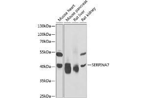 Western blot analysis of extracts of various cell lines, using SERPIN antibody (ABIN6132296, ABIN6147581, ABIN6147582 and ABIN6221920) at 1:1000 dilution. (SERPINA7 anticorps  (AA 146-415))