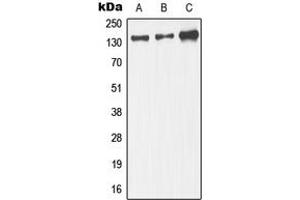 Western blot analysis of JIP3 expression in IMR32 (A), mouse brain. (JIP3 anticorps  (Center))