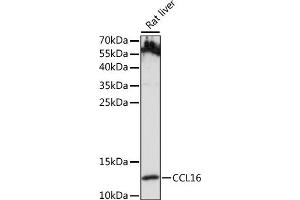 Western blot analysis of extracts of Rat liver, using CCL16 antibody (ABIN7266298) at 1:1000 dilution.