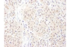 anti-Proteasome (Prosome, Macropain) Activator Subunit 4 (PSME4) (AA 1-50) antibody