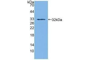 Detection of Recombinant SDH, Human using Polyclonal Antibody to Sorbitol Dehydrogenase (SDH)