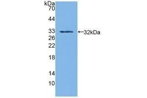 Detection of Recombinant SDH, Human using Polyclonal Antibody to Sorbitol Dehydrogenase (SDH) (SORD anticorps  (AA 98-355))