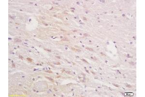 Formalin-fixed and paraffin embedded rat brain tissue labeled with Anti-Squalene EpoxidasePolyclonal Antibody, Unconjugated (ABIN705401) at 1:200 followed by conjugation to the secondary antibody and DAB staining