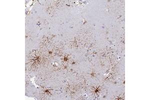 Immunohistochemical staining of human lateral ventricle with ASUN polyclonal antibody  shows distinct positivity in astrocytes and neuropil at 1:200-1:500 dilution. (C12orf11 anticorps)